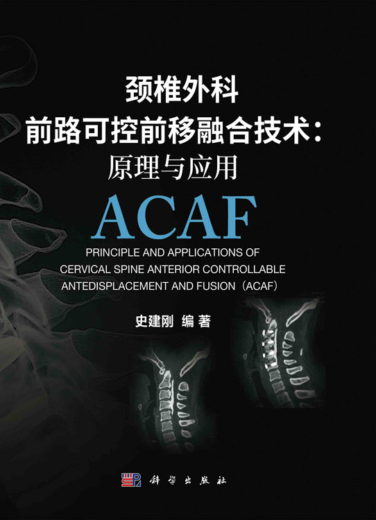 颈椎外科前路可控前移融合技术：原理与应用