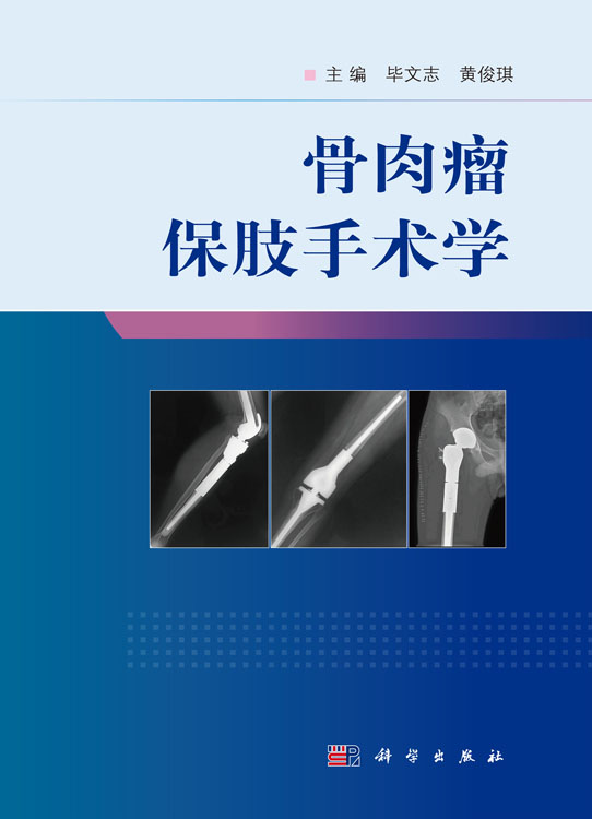 骨肉瘤保肢手术学