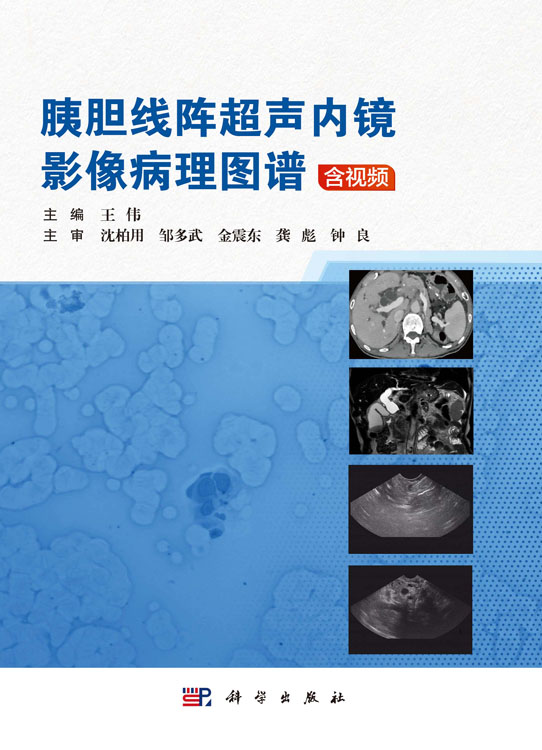 胰胆线阵超声内镜影像病理图谱：含视频