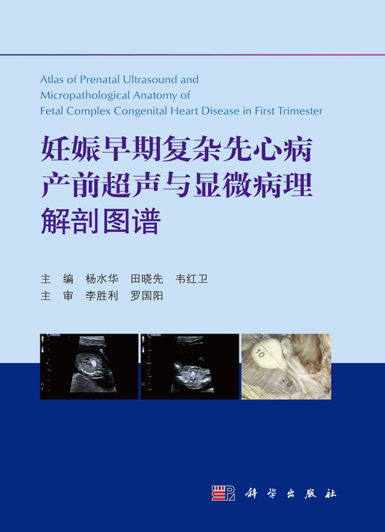 妊娠早期复杂先心病产前超声与显微病理解剖图谱
