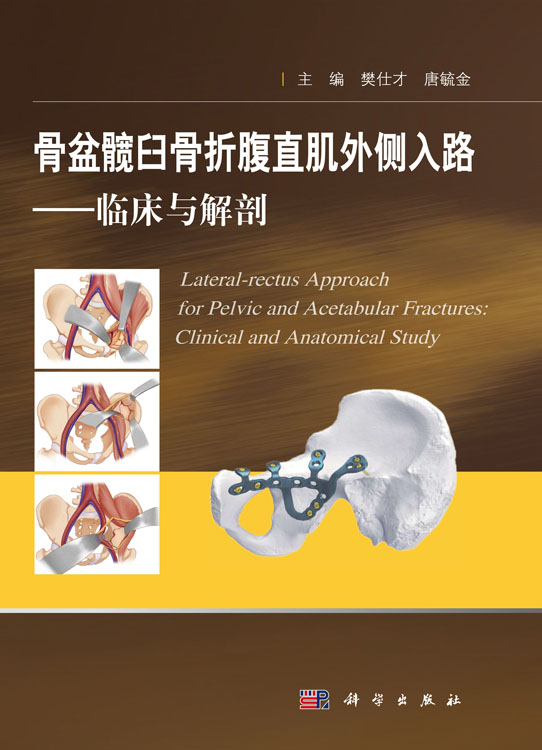 骨盆髋臼骨折腹直肌外侧入路——临床与解剖