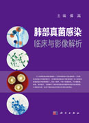 肺部真菌感染临床与影像解析