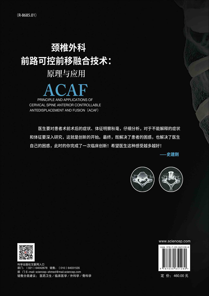 颈椎外科前路可控前移融合技术：原理与应用