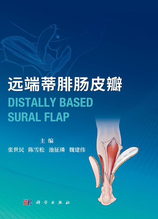 远端蒂腓肠皮瓣