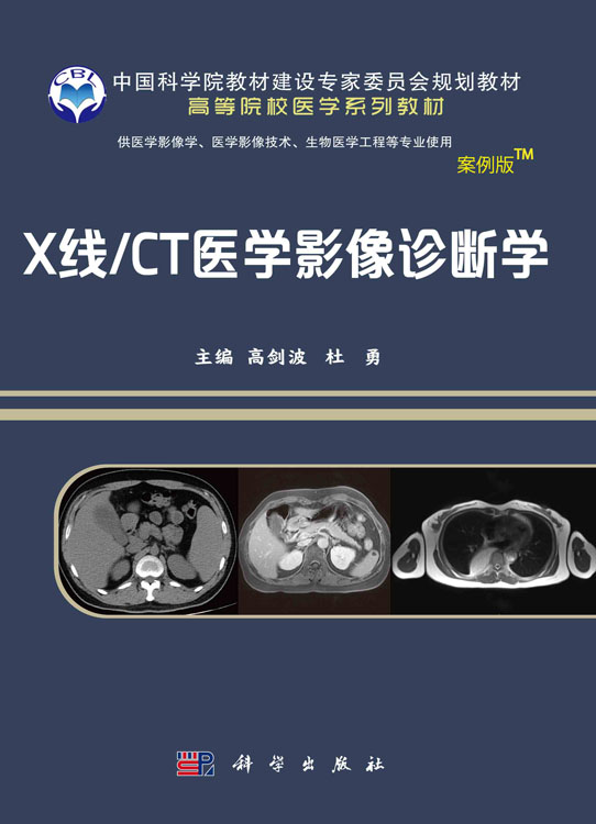 X线/CT医学影像诊断学（案例版-影像系列）