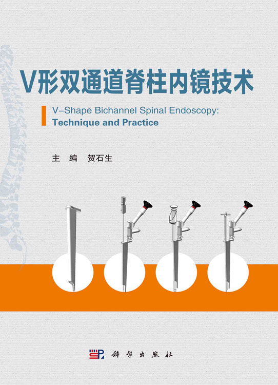 v形双通道脊柱内镜技术