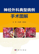 神经外科典型病例手术图解