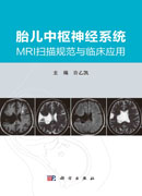 胎儿中枢神经系统MRI扫描规范与临床应用