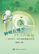 肿瘤在哪里，PET告诉你——PET/CT、PET/MRI基础与应用