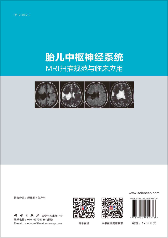 胎儿中枢神经系统MRI扫描规范与临床应用