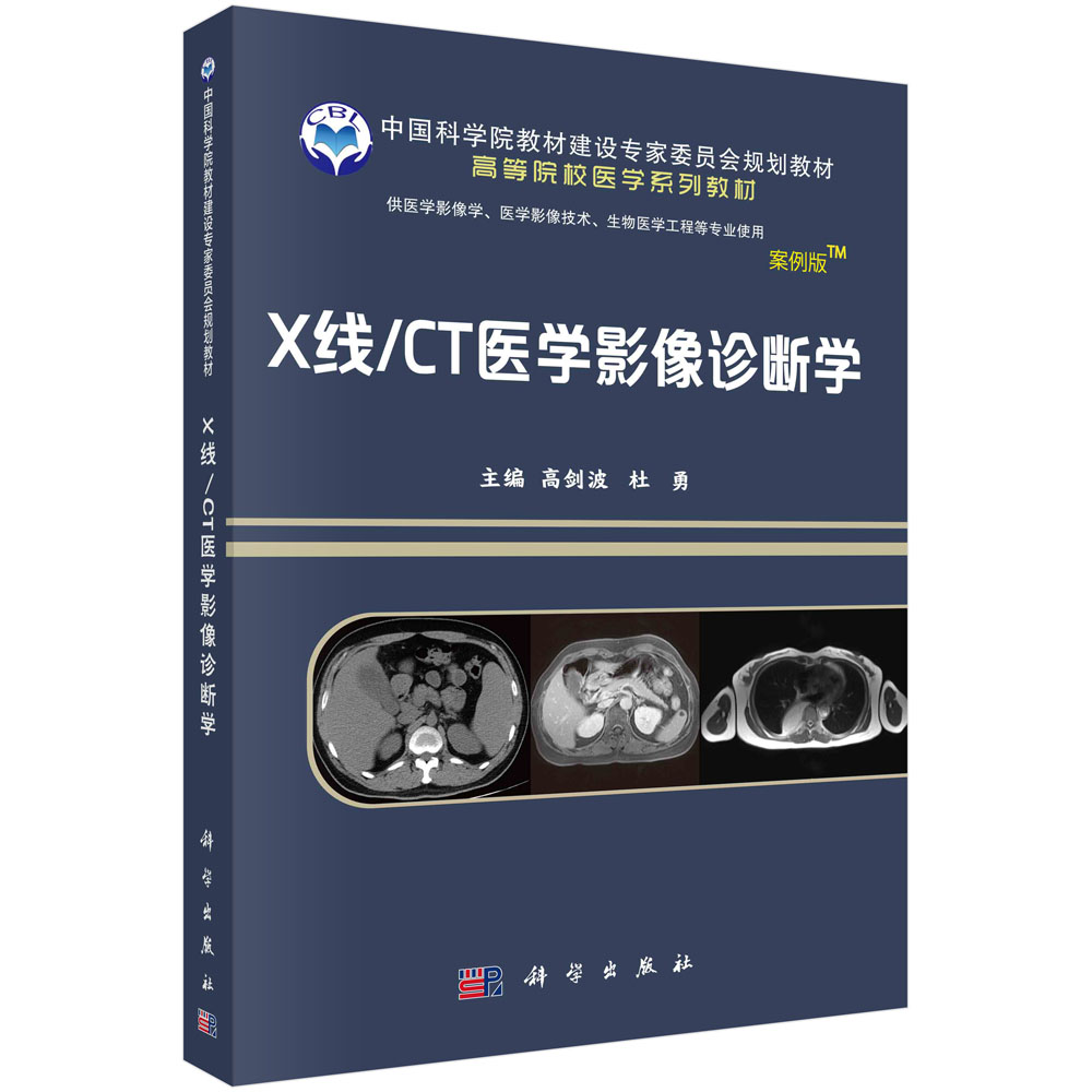 X线/CT医学影像诊断学（案例版-影像系列）