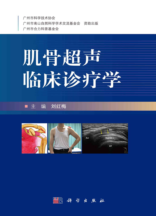 肌骨超声临床诊疗学