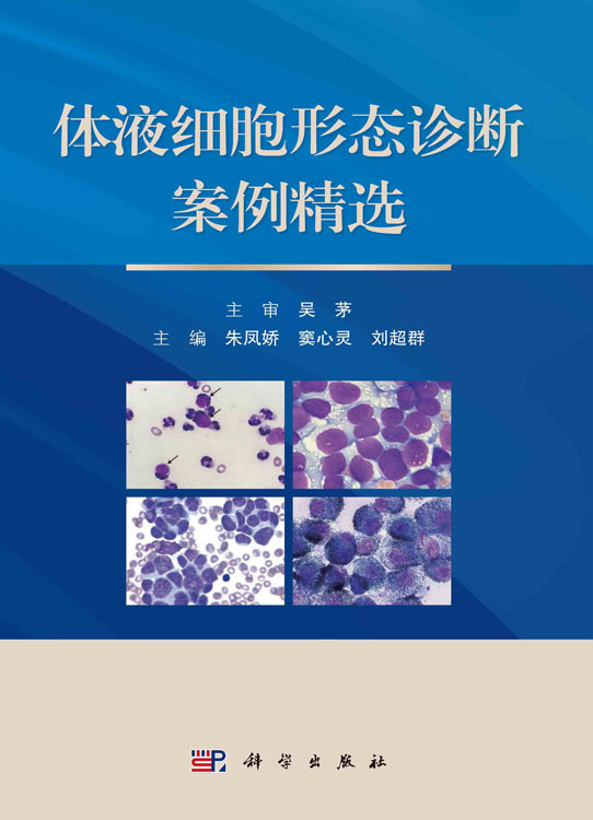体液细胞形态诊断案例精选