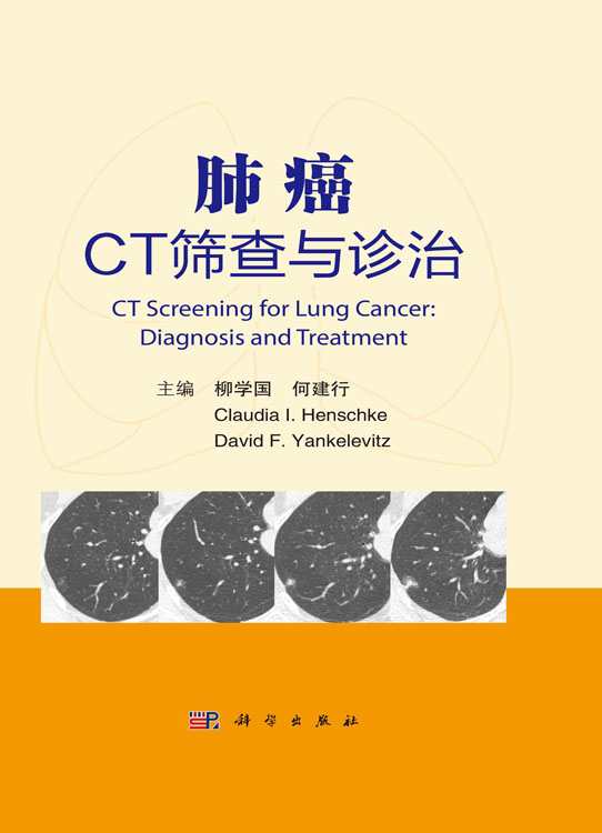 肺癌CT筛查与诊治