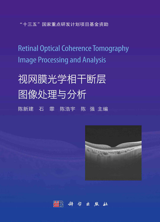 视网膜光学相干断层图像处理与分析