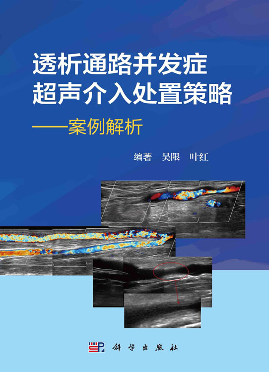 透析通路并发症超声介入处置策略：案例解析
