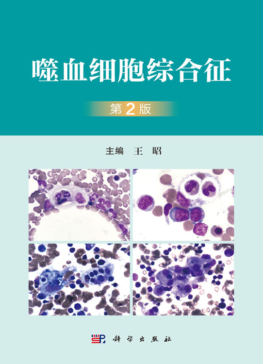 噬血细胞综合征（第2版）