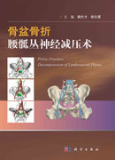 骨盆骨折腰骶丛神经减压术
