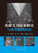 乳腺X线征象解读与典型病例图谱