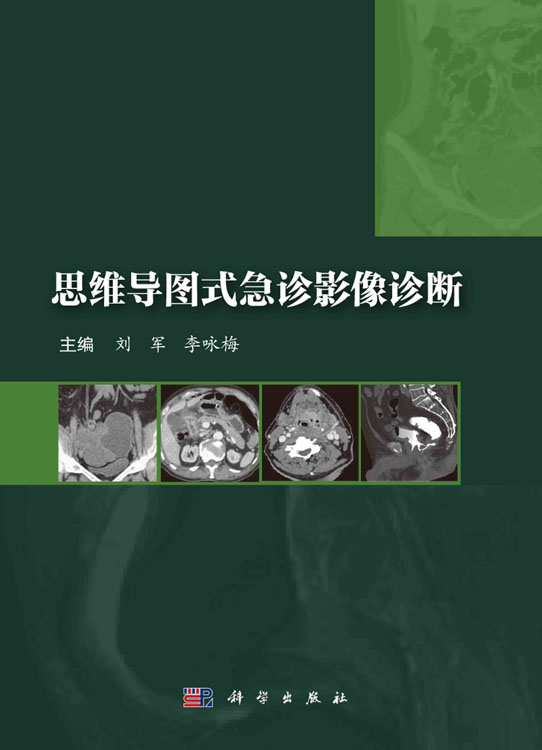 思维导图式急诊影像诊断