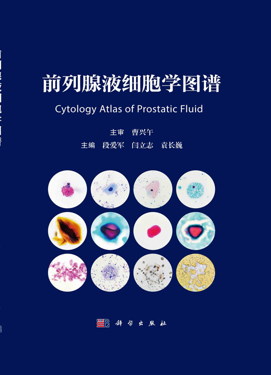 前列腺液细胞学图谱