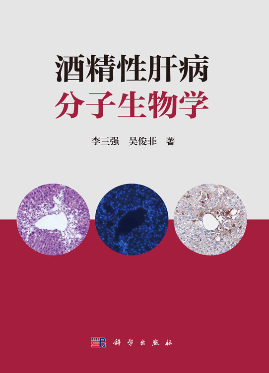 酒精性肝病分子生物学