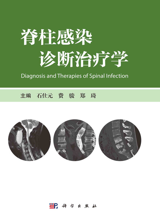 脊柱感染诊断治疗学