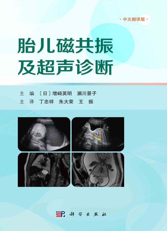 胎儿磁共振及超声诊断