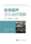 肌骨超声介入治疗图解