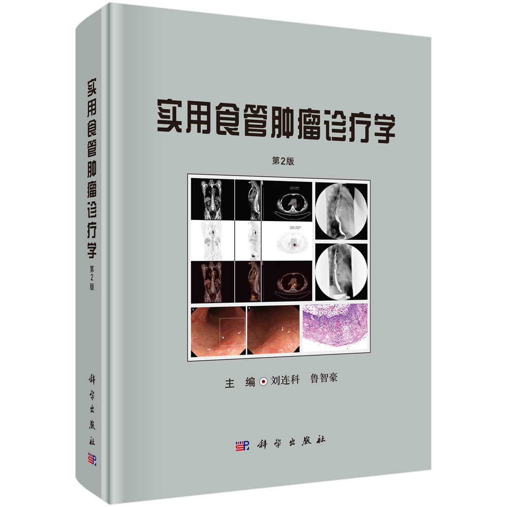 实用食管肿瘤诊疗学（第2版）