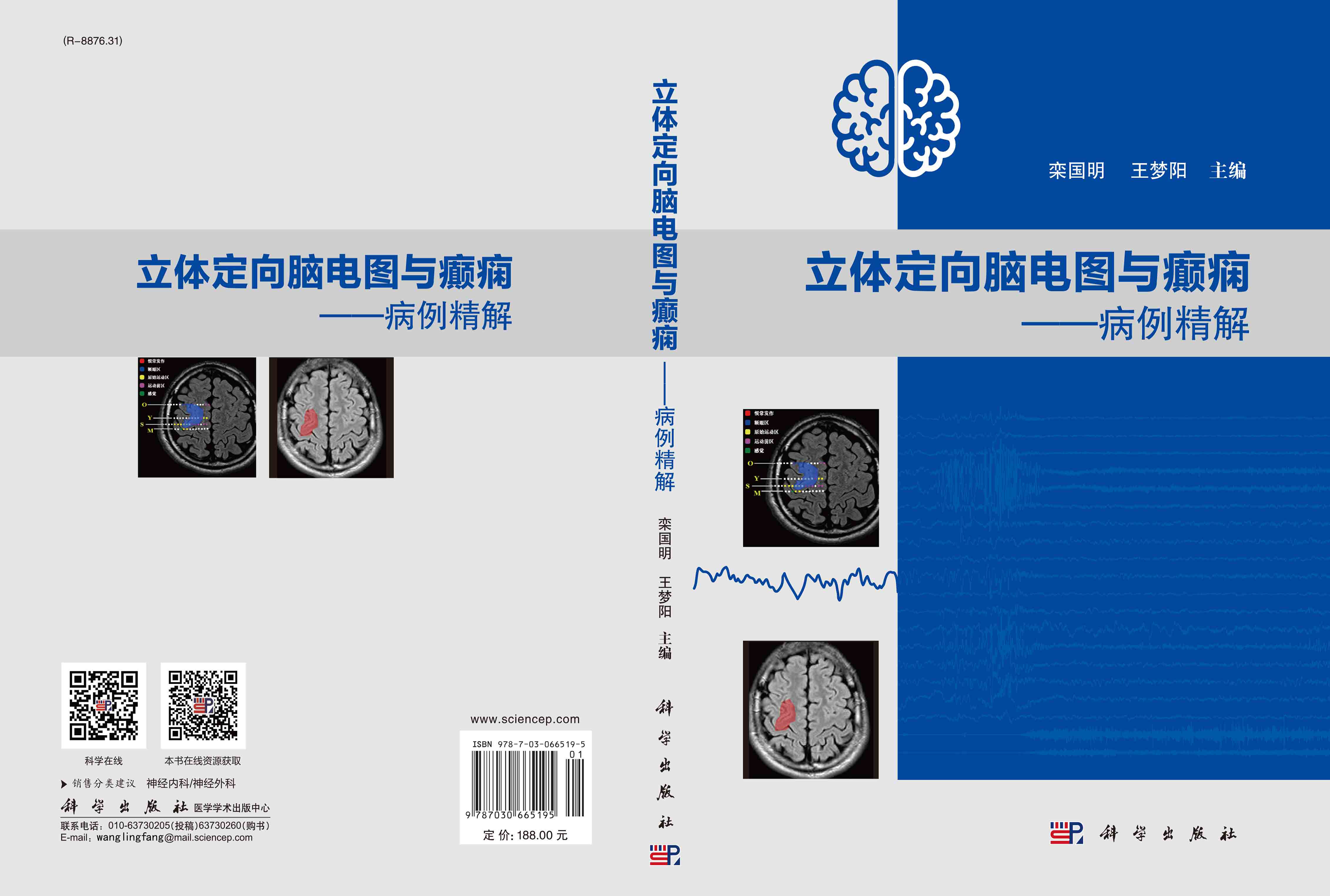 立体定向脑电图与癫痫：病例精解