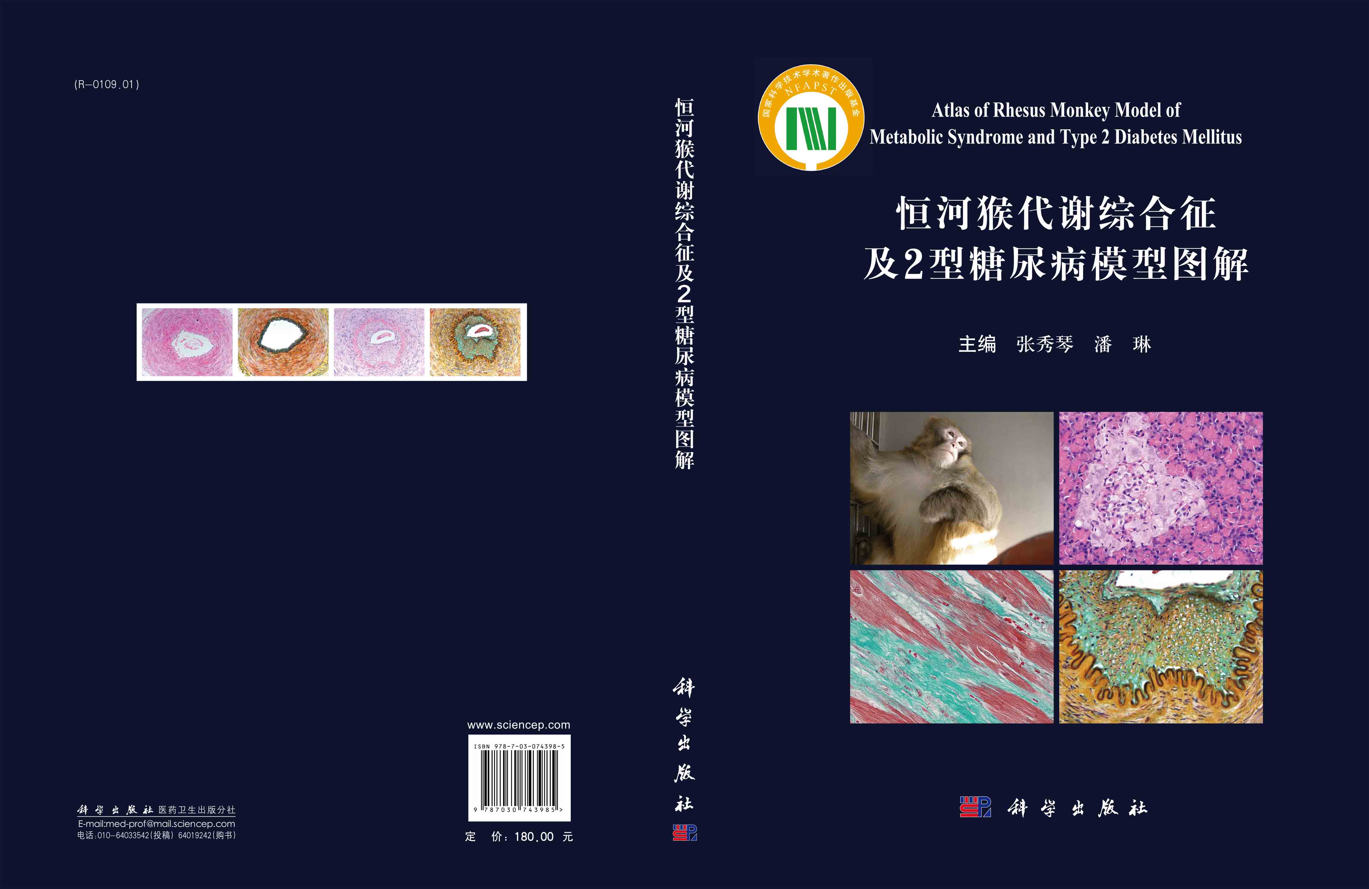 恒河猴代谢综合征及2型糖尿病模型图解