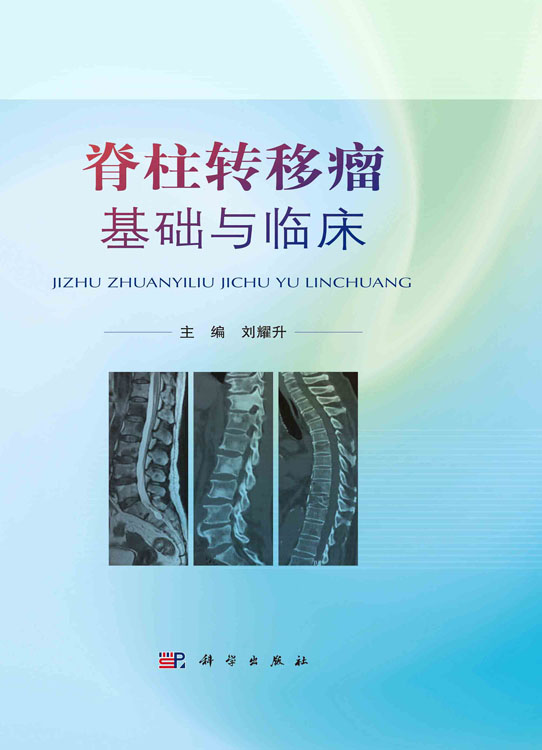 脊柱转移瘤基础与临床