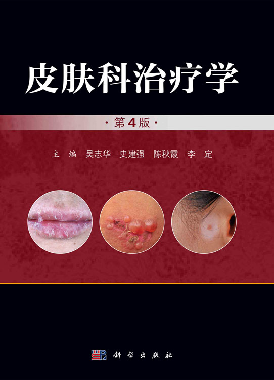 皮肤科治疗学（第4版）