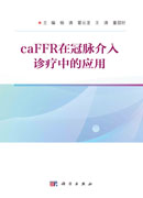 caFFR在冠脉介入诊疗中的应用