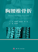 胸腰椎骨折