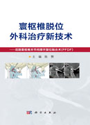 寰枢椎脱位外科治疗新技术——后路寰枢椎关节间撑开复位融合术（PFDF）