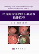 结直肠内镜黏膜下剥离术操作技巧