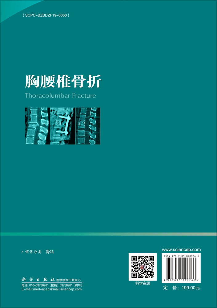 胸腰椎骨折