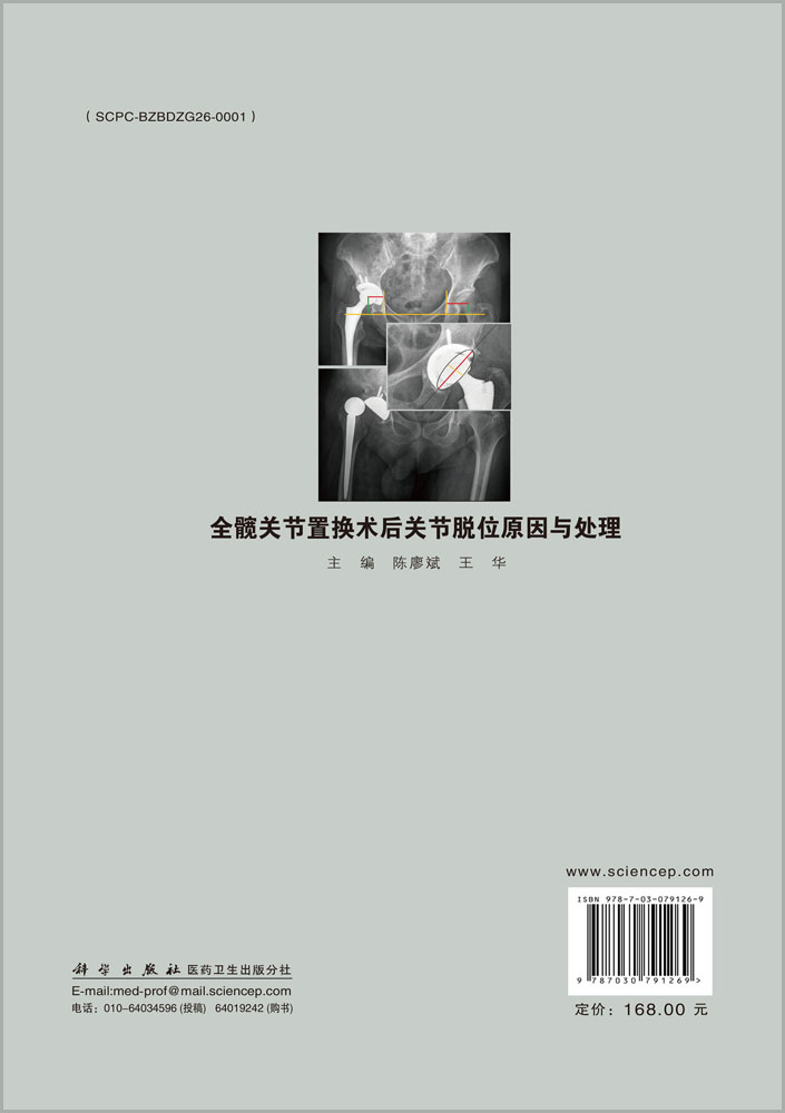 全髋关节置换术后关节脱位原因与处理