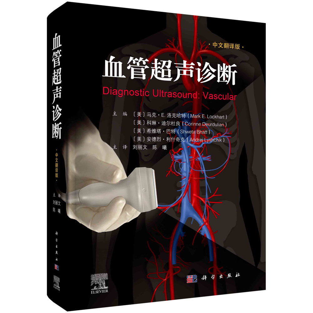 血管超声诊断