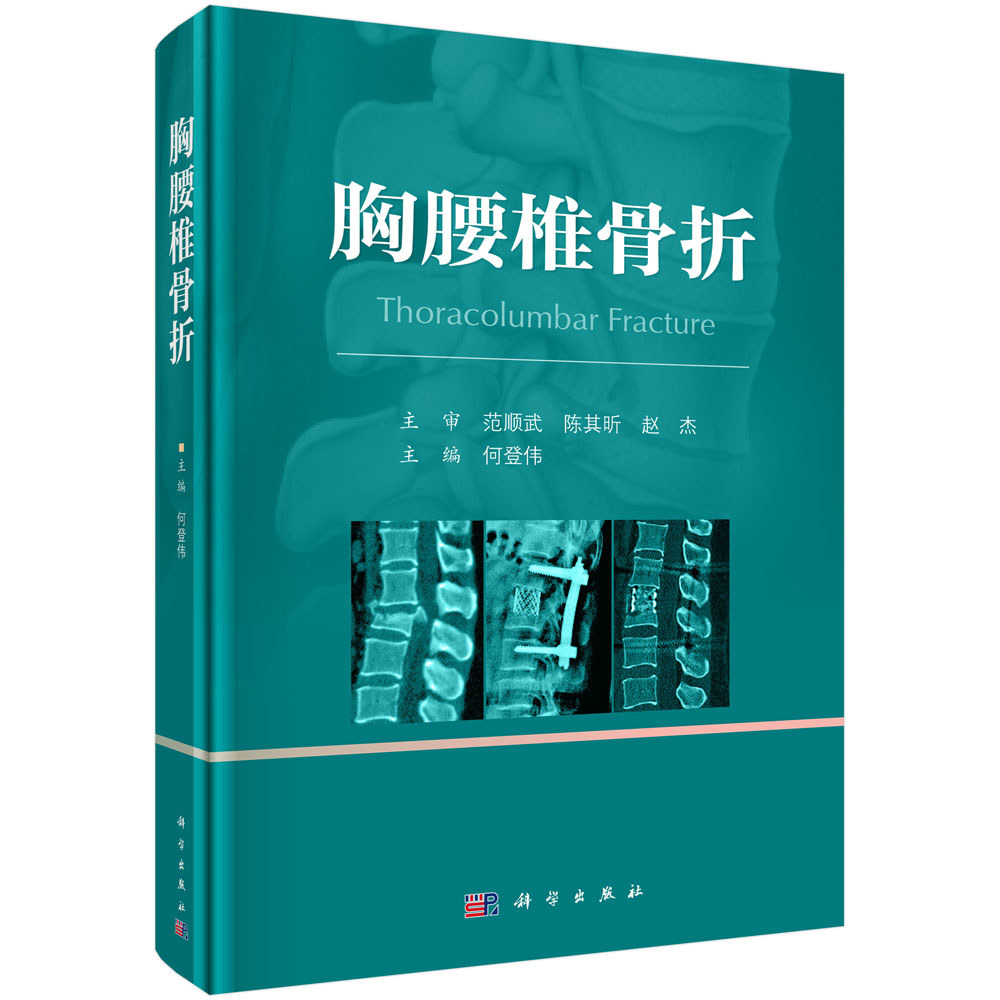 胸腰椎骨折