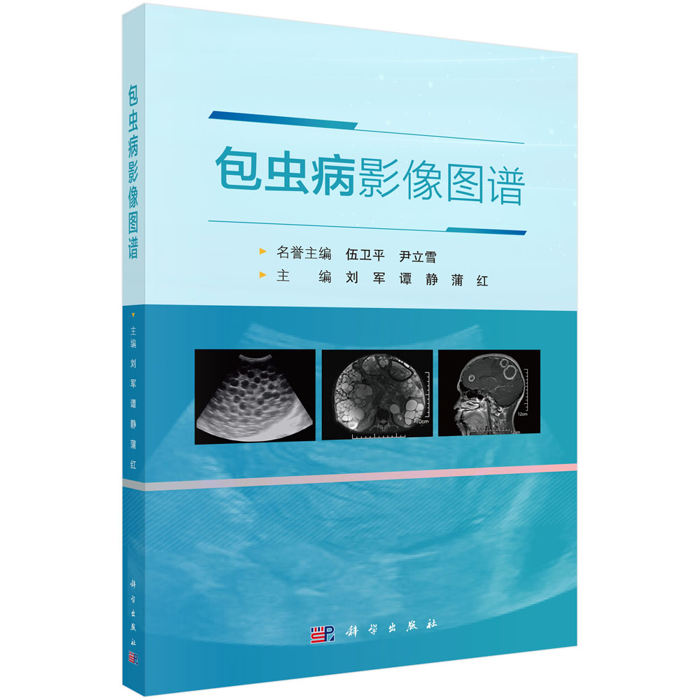 包虫病影像图谱