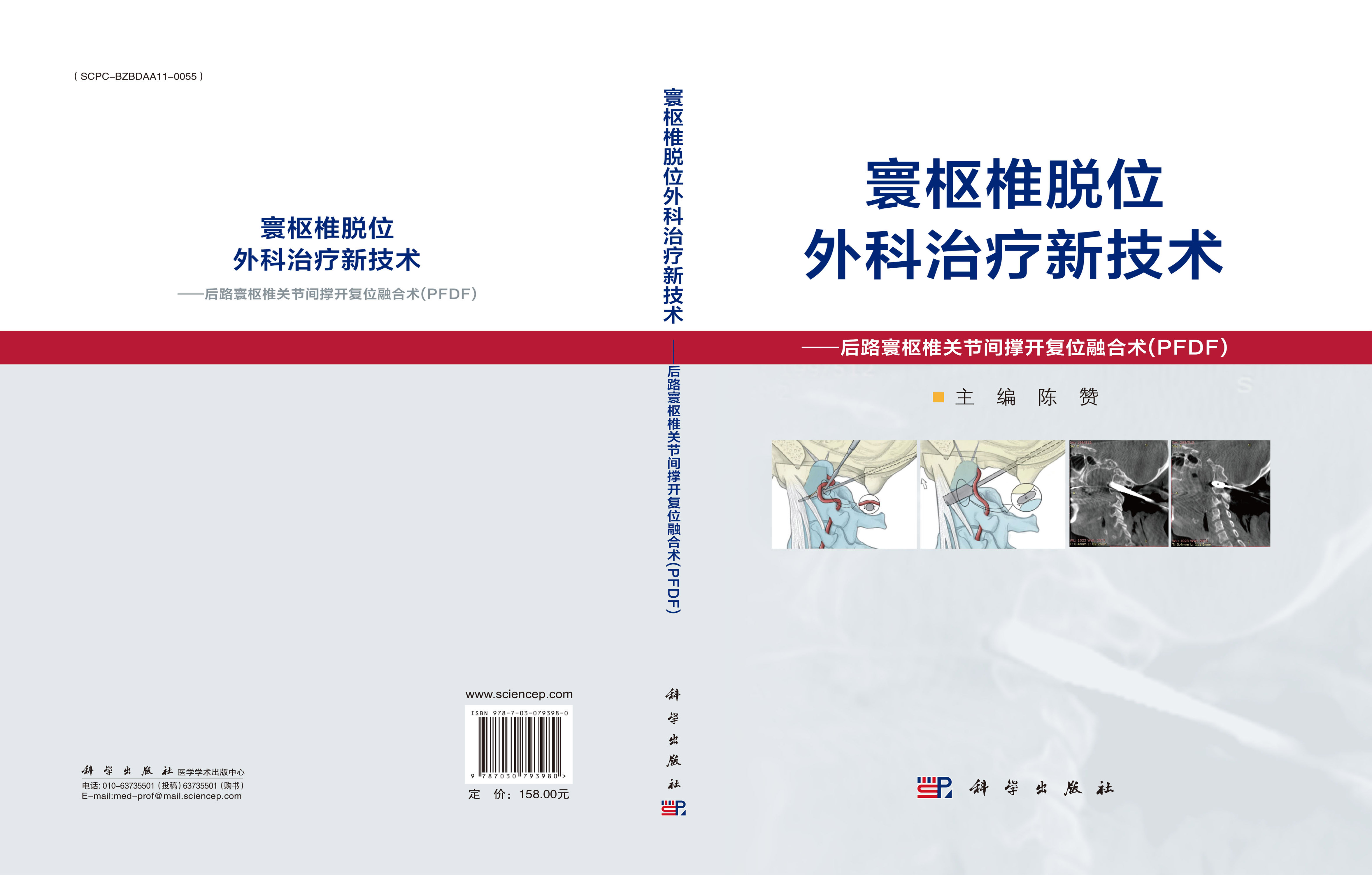 寰枢椎脱位外科治疗新技术——后路寰枢椎关节间撑开复位融合术（PFDF）