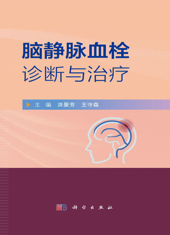 脑静脉血栓诊断与治疗