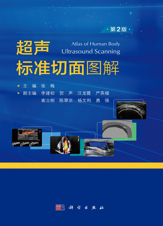 超声标准切面图解（第2版）