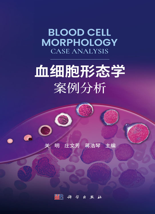 血细胞形态学案例分析