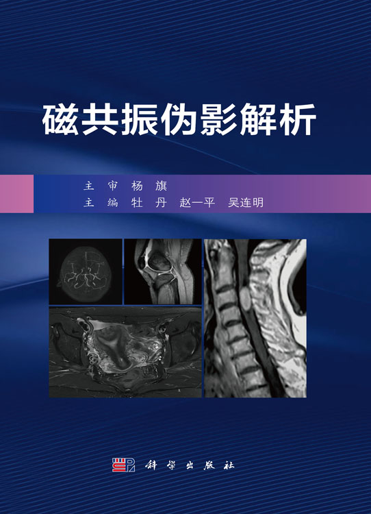 磁共振伪影解析