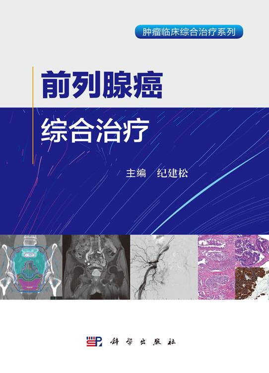 前列腺癌综合治疗