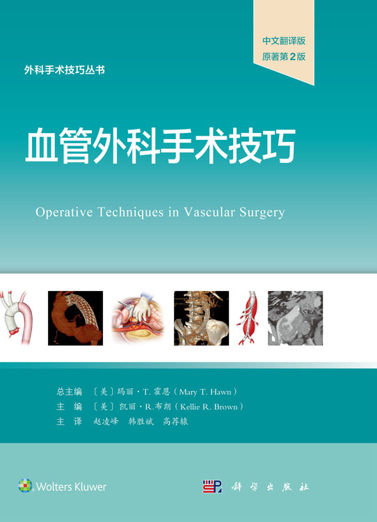 血管外科手术技巧